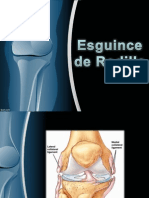 Expo Esguince Rodilla