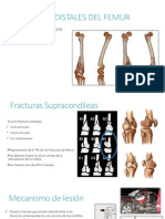 Fracturas Distales Del Femur CRP - Trauma