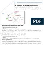 El Electrocardiograma Bloqueos de Rama y Hemibloqueos PDF