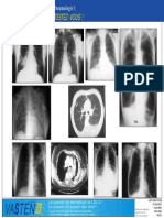 Test Pneumologie