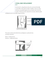 Knee Replacement