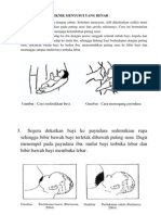 Teknik Menyusui Yang Benar