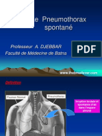 Le Pneumothorax Spontané