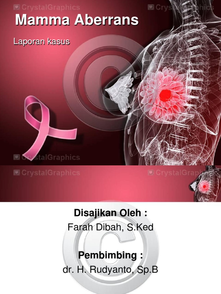 Biaya Operasi Mammae Aberans Perumperindo.co.id