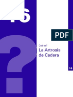 Artrosis de Cadera