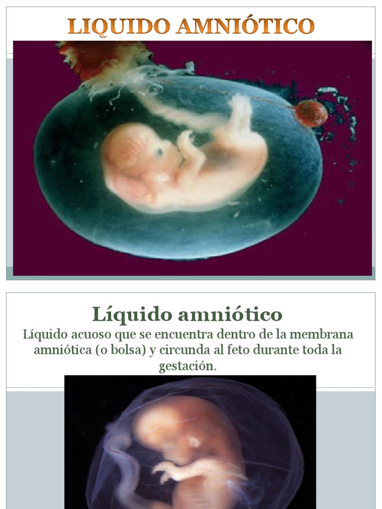 12.liquido Amniotico y Sus Alteraciones PDF El embarazo Parto