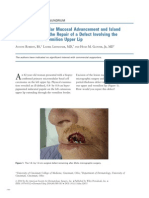 Combined Vestibular Mucosal Advancement and Island Pedicle Flaps for the Repair of a Defect Involving the Cutaneous and Vermilion Upper Lip