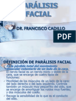 7 Paralisis Facial