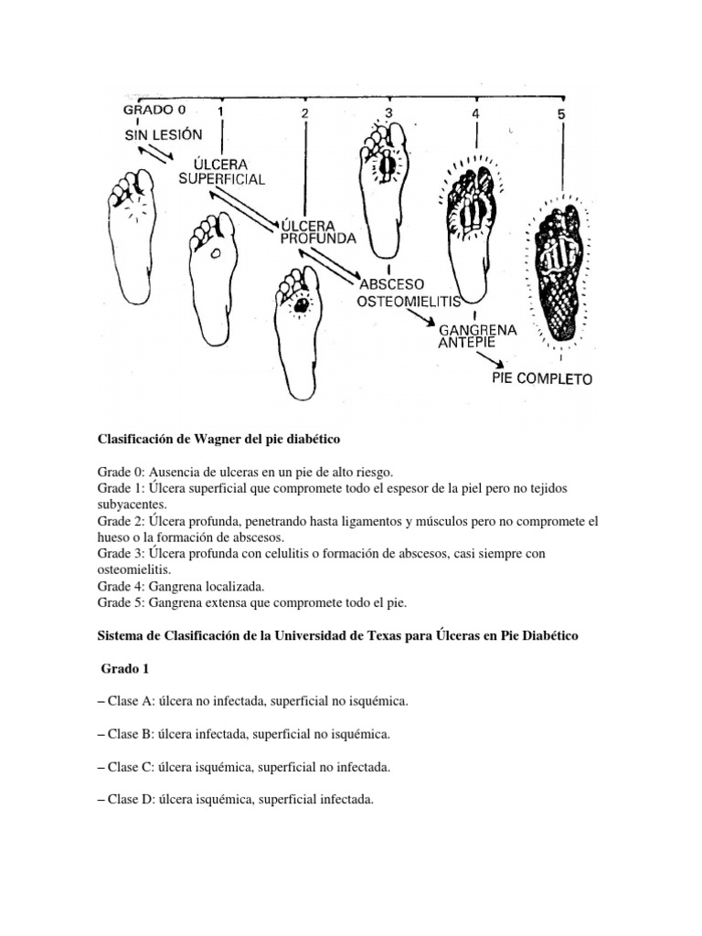 Clasificación de Wagner Del Pie Diabético