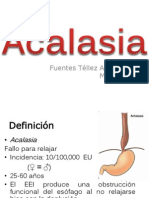 Acalasia