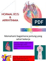 Skill Baca EKG