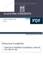 Glaucoma Congénito- Presentacion