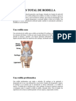 Protesis Total de Rodilla Pacientes