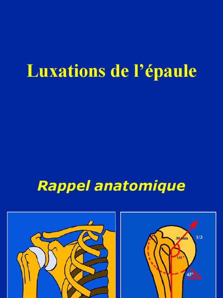03 - Epaule Luxations | PDF | Trouble musculosquelettique | Anatomie ...