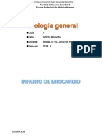 infart miocardio