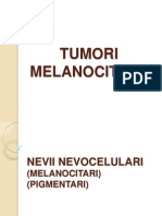 Tumori Melanocitare