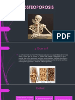 Osteoporosis