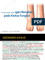 Ppt2. Wanita Dengan Bengkak Pada Kedua Tungkai