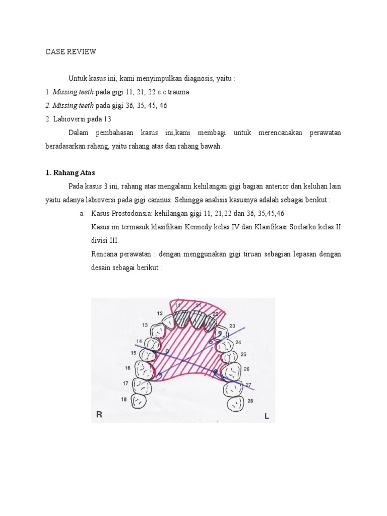 Case Review Rahang Atas | PDF