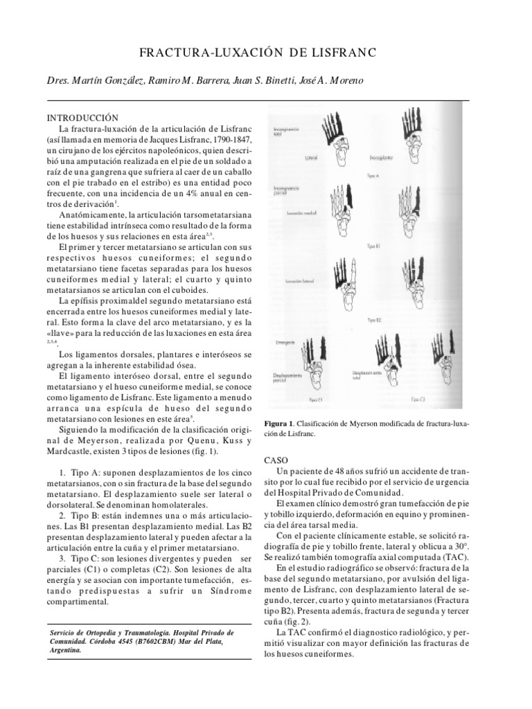Clasificación de Myerson en Lisfranc | PDF | Pie | Ct Scan