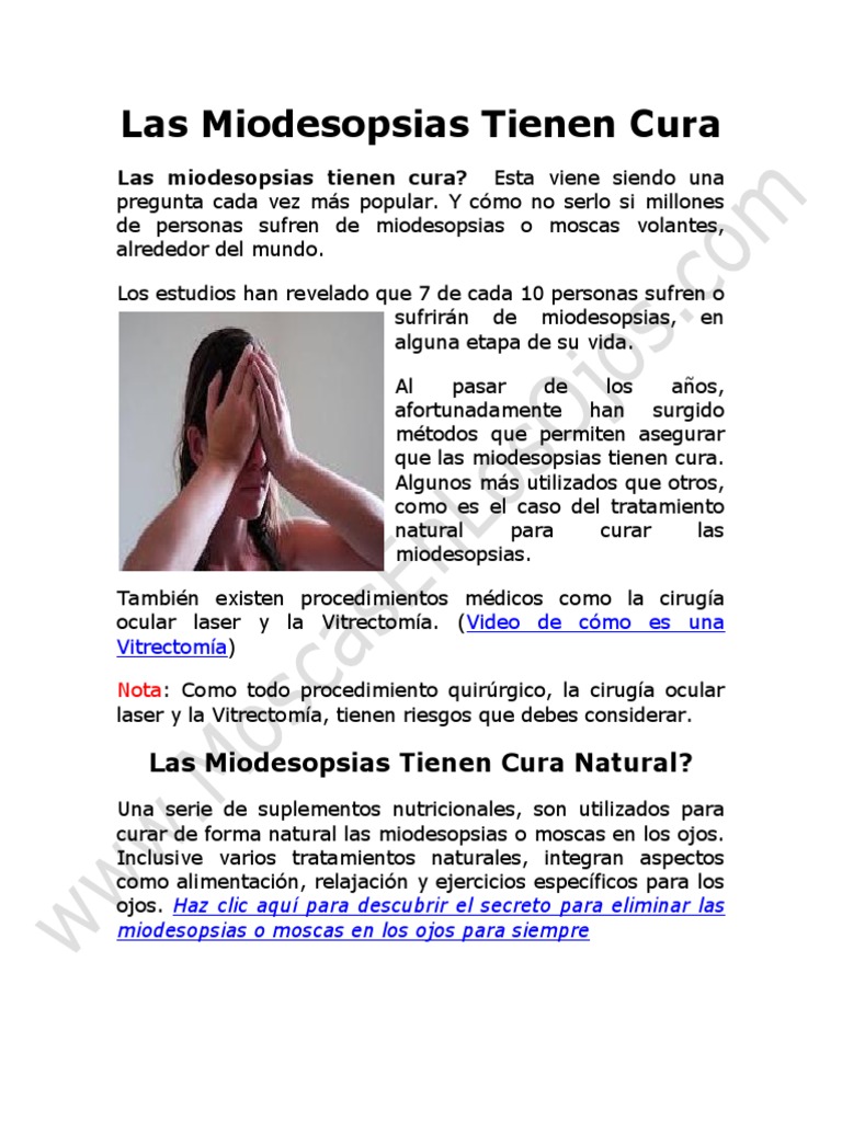 Las Miodesopsias Tienen Cura Que Hacer para Eliminarlas: Ya Tienen Las ...