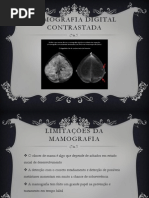 Mamografia Digital Contrastada