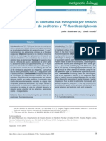 Demencias Valoradas Con Tomografía Por Emisión de Positrones y F-Fluordesoxiglucosa