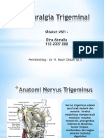 Neuralgia Trigeminal