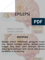 Epilepsi