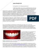 Article Blanqueamiento Dental