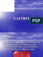 Gastritis