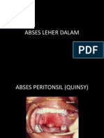 Abses Leher