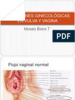 Infecciones Ginecológicas en Vulva y Vagina