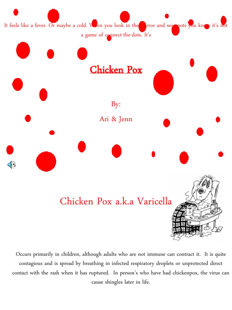 Chicken Pox | Public Health | Immunology