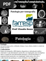 Patologia Por Tomografia Computadorizada