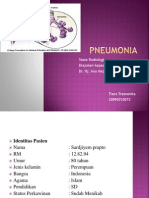 Pneumonia Radiologi