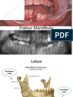 Fraktur Mandibula-Leher