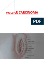 Vulval Ca