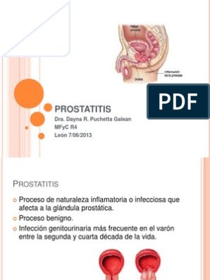 prostatitis atb A prosztata gyulladása Mi az