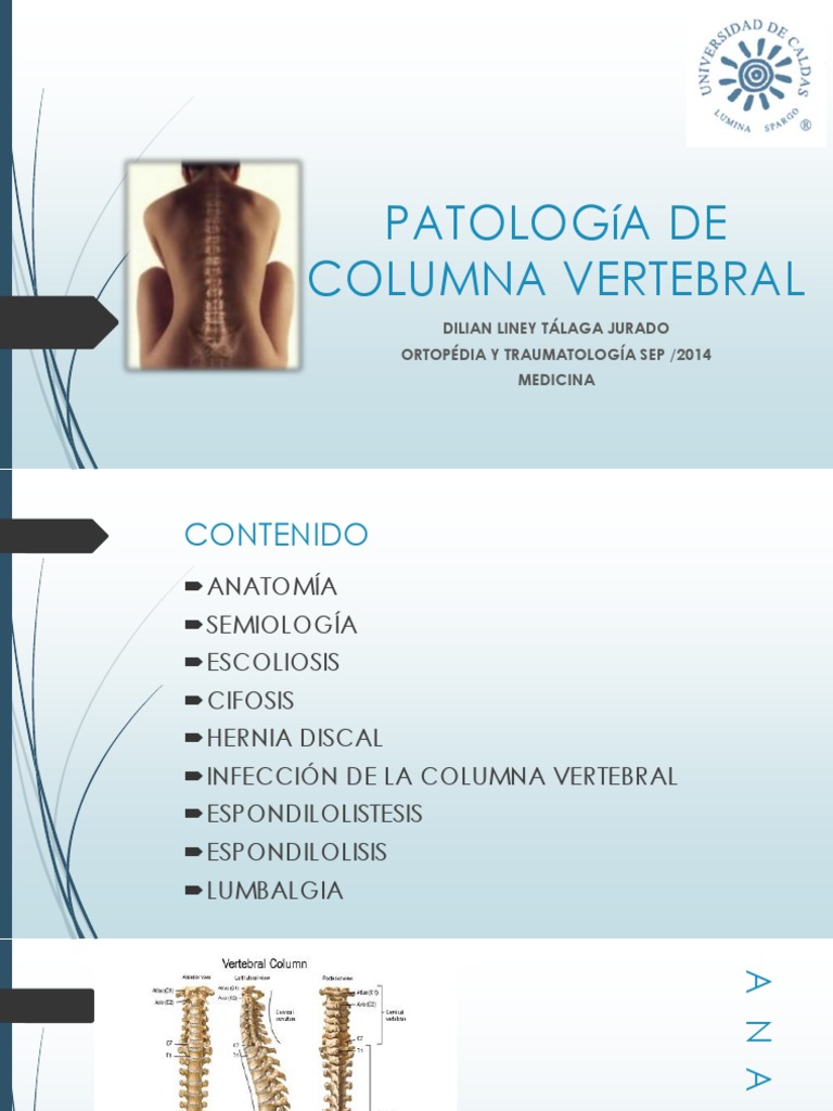 Patología de la Columna Vertebral | PDF | Dolor lumbar | Ciencias de la ...