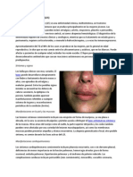 Lupus Eritematoso Sistémico PDF