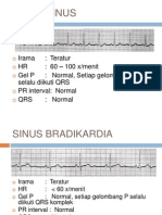 Ekg Lethal