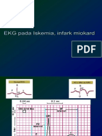 Ekg II ACS