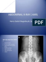 Abdominal X-Ray (Axr)