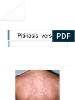 Pitiriasis  versikolor ppt