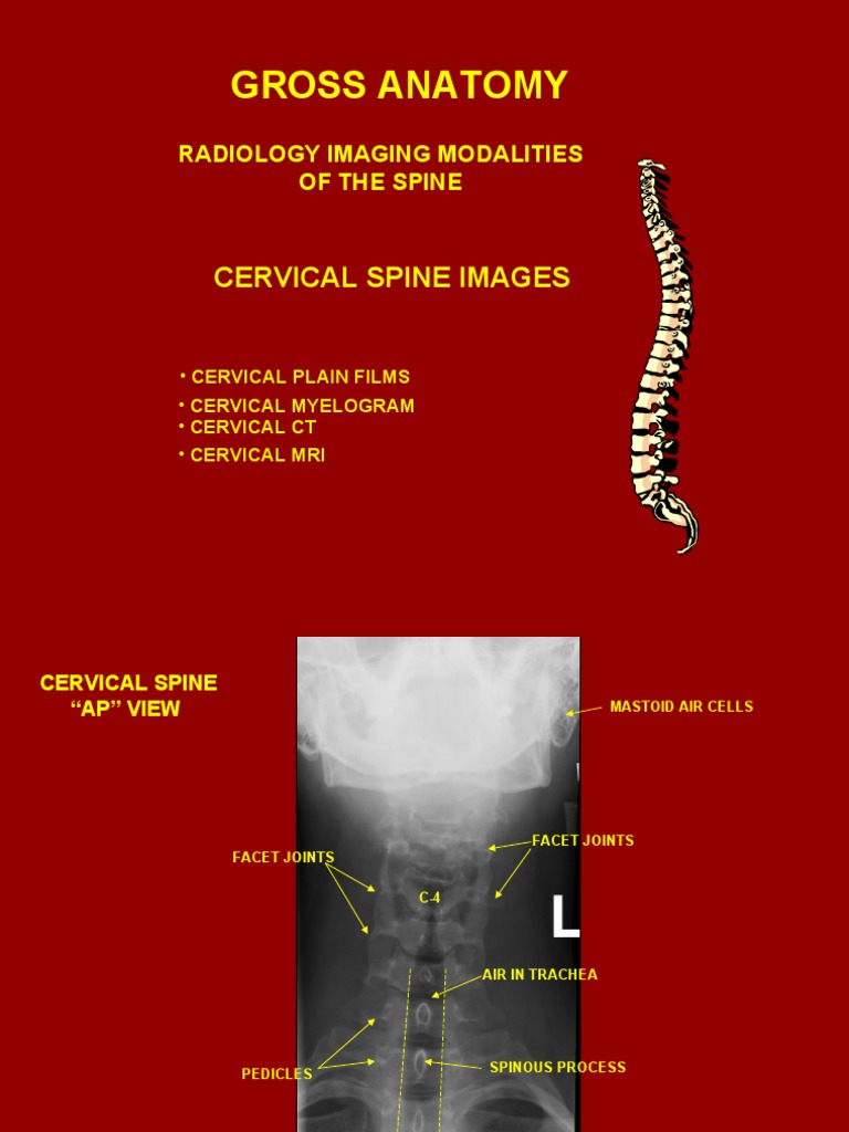 RADIOLOGY IMAGING MODALITIES OF THE SPINE. Cervical Spine Images | PDF ...