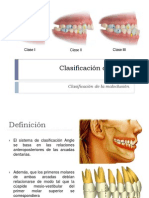 Clasificación de Angle