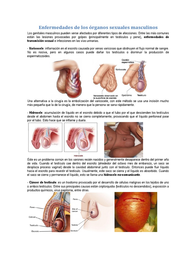 Enfermedades Del Hombre | PDF | Testículo | Cáncer, image size:768x1024
