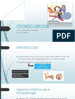 OTOESCLEROSIS