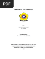 Download Dermatitis Kontak Iritan by Shabrina Frimasari SN243013584 doc pdf